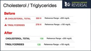 Cholesterol and Triglycerides