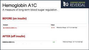 Hemoglobin A1C before and after